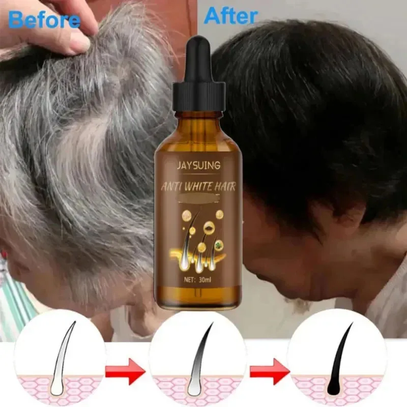 Suero de tratamiento para el cabello antigris duradero, reparación de cabello blanco a negro, Color Natural, reparación de daños, cuidado, productos de crecimiento para hombres y mujeres