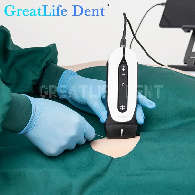 GreatLife Dent SonoEye P1 P2 P3 P5 P6 microconvexo portátil, máquina de escaneo de ultrasonido de mano, sistema de examen Digital