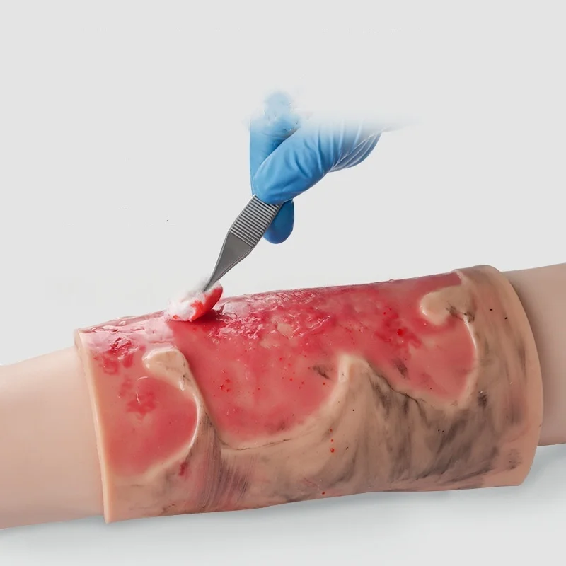 Wearable 2-3 Degree Limb Burns Training Module High Simulation Limb Burn Model Medical Student Nurse Training Model