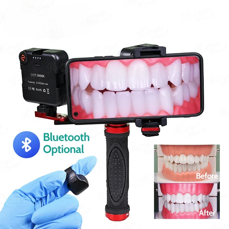 

Dentals Dentistry LED Oral Filling Light Flash Photography Equipment 64 Lamp Beads Brightness Adjustment