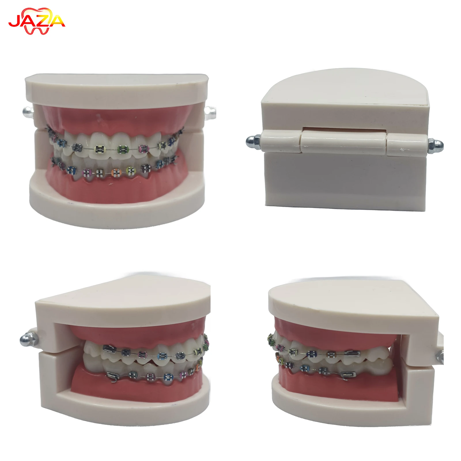 Detachable Orthodontic Dental Model with Metal Braces – Resin Teeth Demonstration Model for Dental Education & Patient Communic
