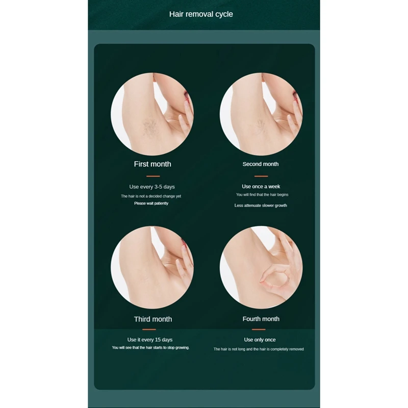 동결 점 제모 장치, 가정용 레이저 제모 장치, 체모 제거, 흰색 미국 플러그, 2in 1