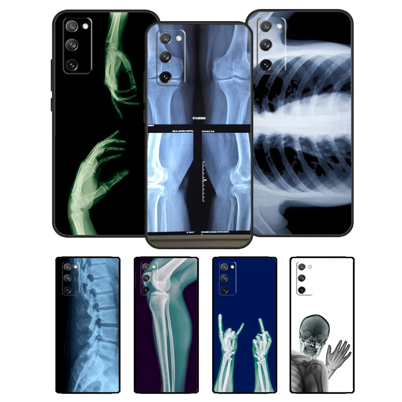 X-ray Hand Bones Silicone Case For Samsung Galaxy S8 S9 S10 S20 FE S21 Plus Note 20 Ultra S22 Ultra Cover