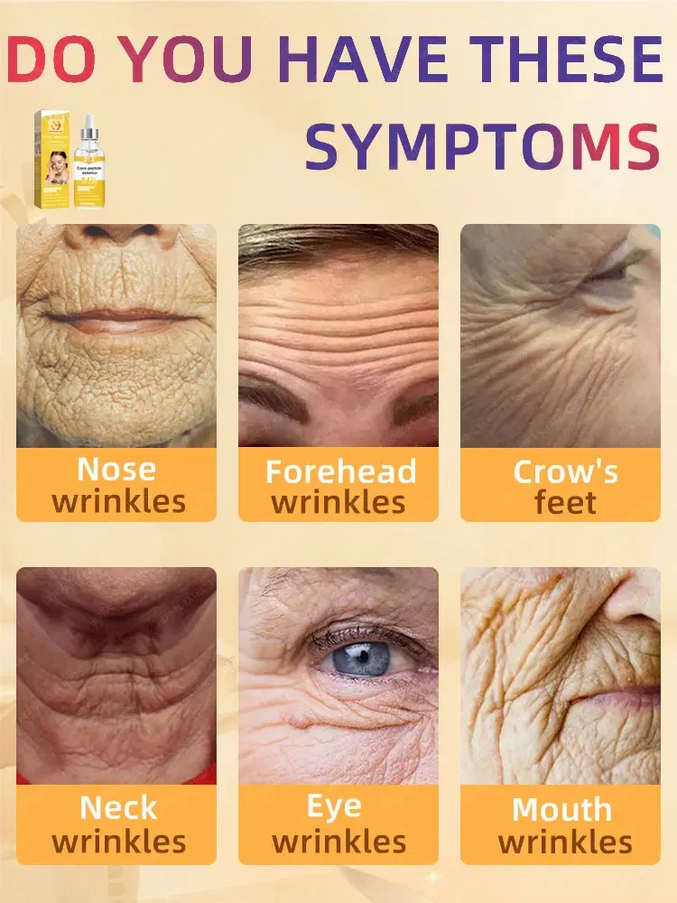 Do you Want to Remove wrinkles on your face and solve the problem of skin firming?