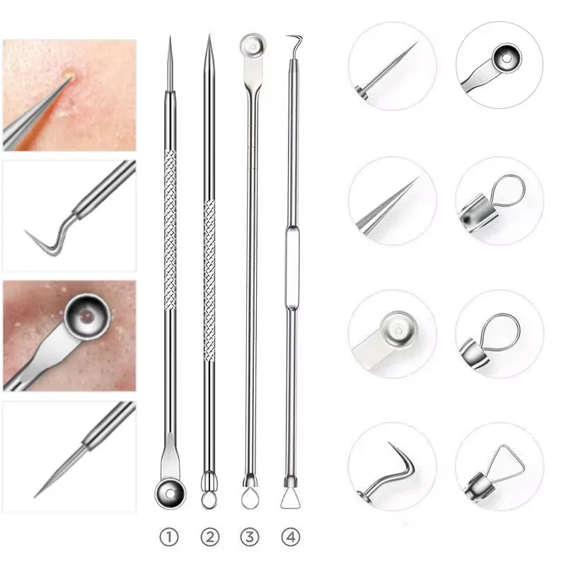 4 stks/8 stks/set Facial Pore Cleaner Lepel Mee-eter Comedo Acne Puistje Comedondrukker Tool Naalden Voor Gezicht huidverzorging Tool