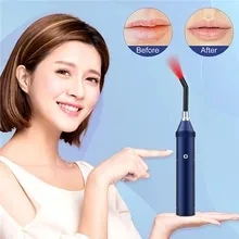 

Red Light Therapy Device Cold Sore Canker Sore Treatment Infrared Light Therapy Wand for Mouth Nose Ear Knee Feet Hands Ankle