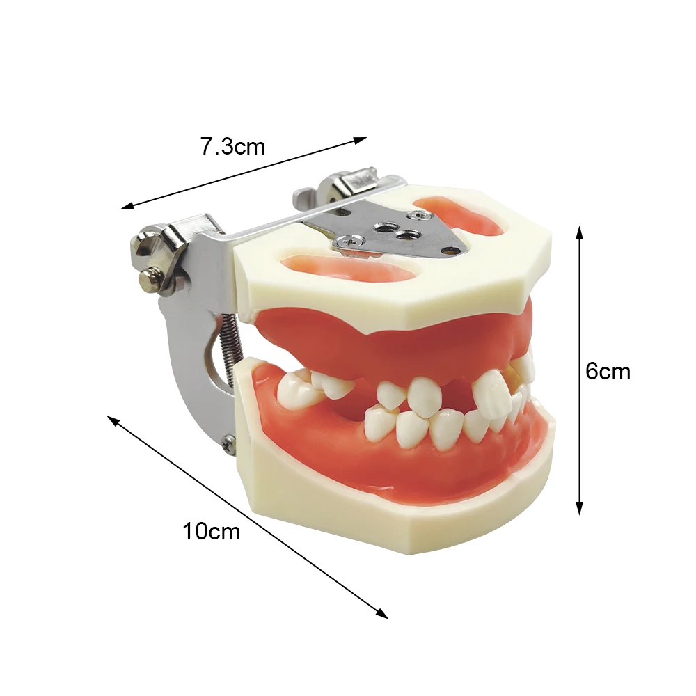 Dental Implant Model Maxillary Mandible Sinus Training Model Missing Tooth Upper Lower Jaw Implant Teeth Practice Teaching Model