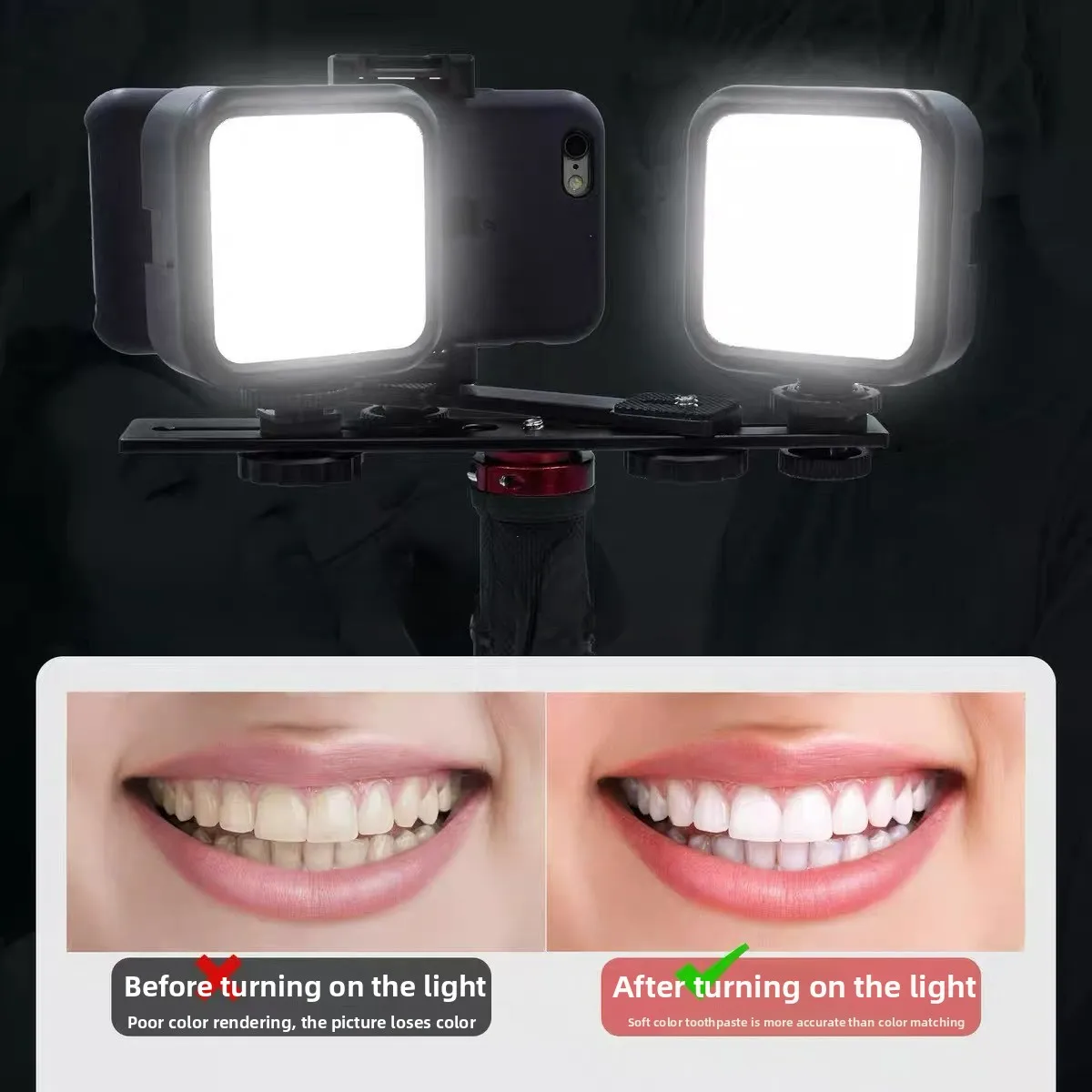 Dental Photography Light with Bluetooth Oral Photo Lighting LED Flashlight Cavity Exam Treatment Mobile Lamp Filling Video