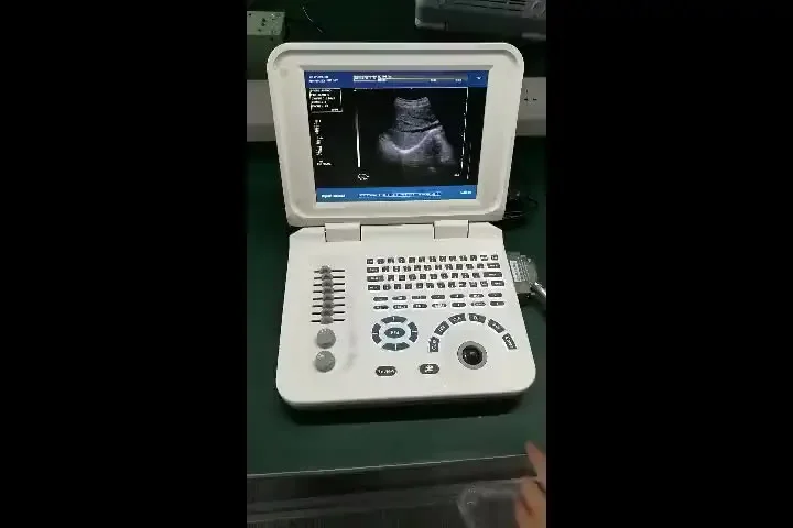 Wholesale factory direct sales fashionable pregnancy ultrasound