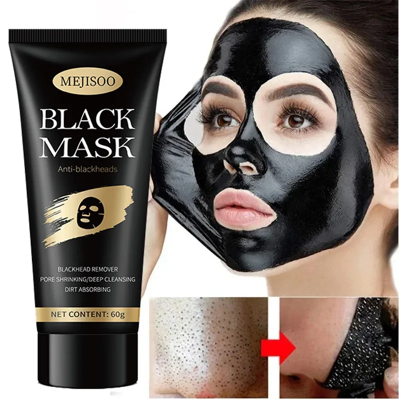 Blackhead Removing Facial Mask Absorbs Acne Black Facial Mask Cleanses Acne Men And Women Moisturize And Apply Facial Mask