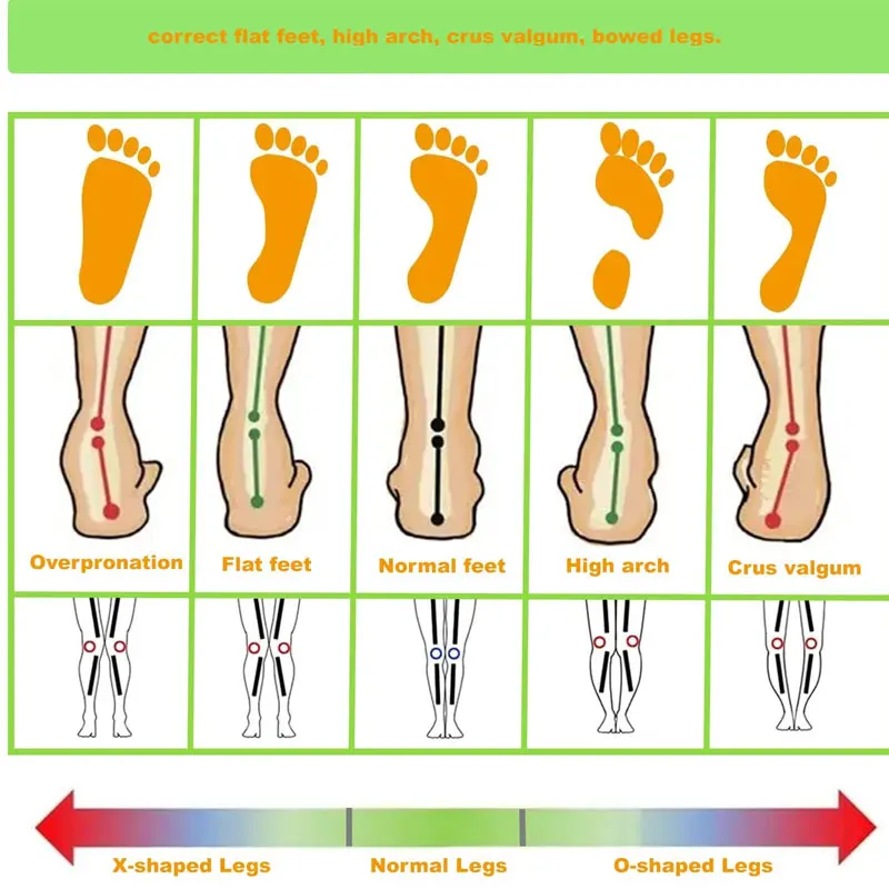 Unisex Orthotics Flat Foot High Arch Support Orthopedic Insoles Soft Breathable Orthotic Arch Foot Running Sports Shoes Pads