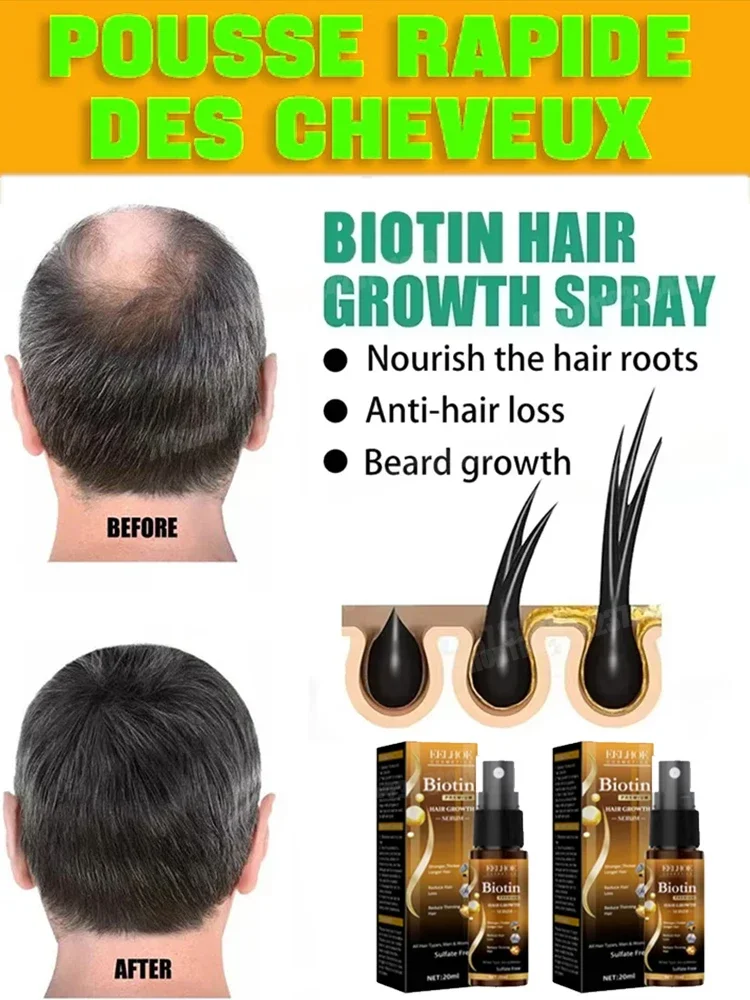 

Solve your problem and let us have Better hair