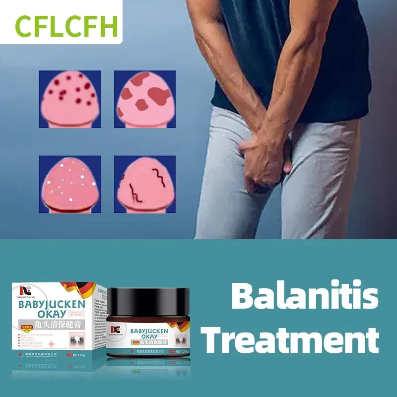 

Germany Balanitis Treatment Cream Papules Pearl Rash Red White Dot Itch Fungal Glans Foreskin Ointment Anti Infection Medicine