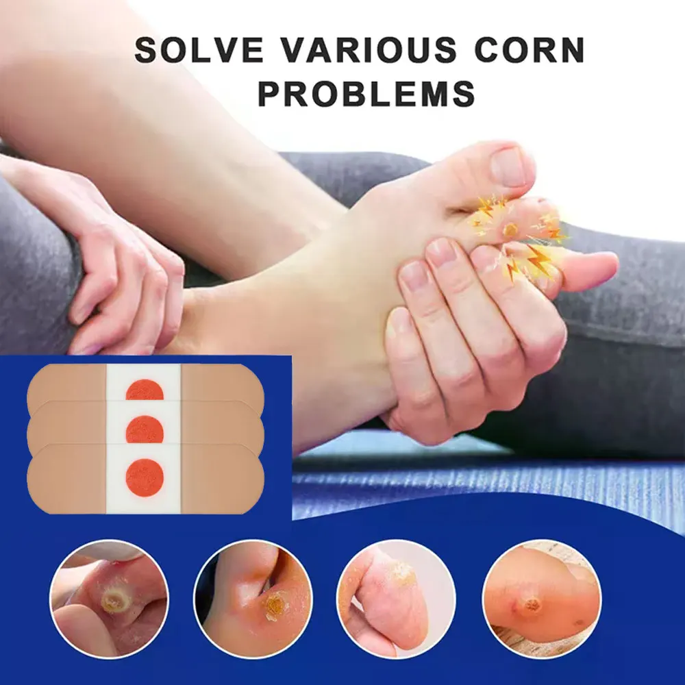 Foot Care Sticker Medical Patch Corn Removal Pads Curative Patches Calluses Remove Callosity Detox Summer Foot Care Patch