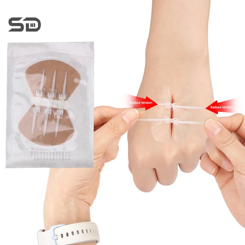 Zipper Band-aid Painless Wound Closure Device Suture-free Wound Dressing Patches Zip Suture Reducer Elastic Bandage