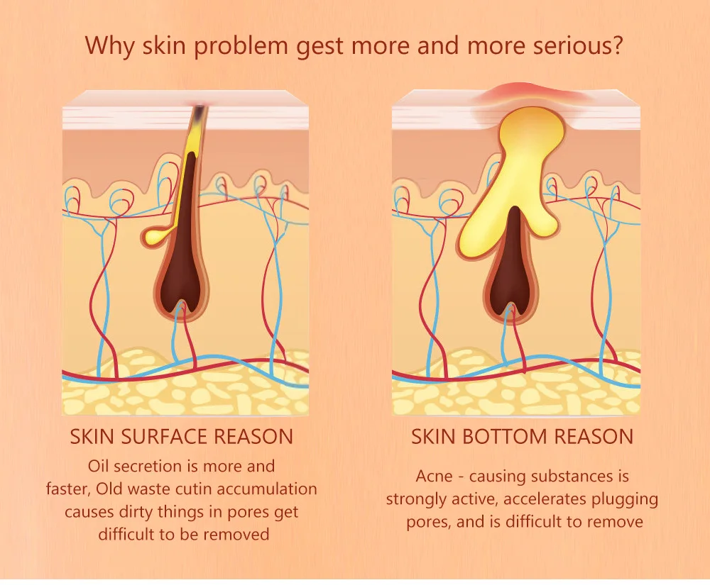 Serum pengecil pori-pori, krim laktobionik pengencang wajah perawatan kulit Korea