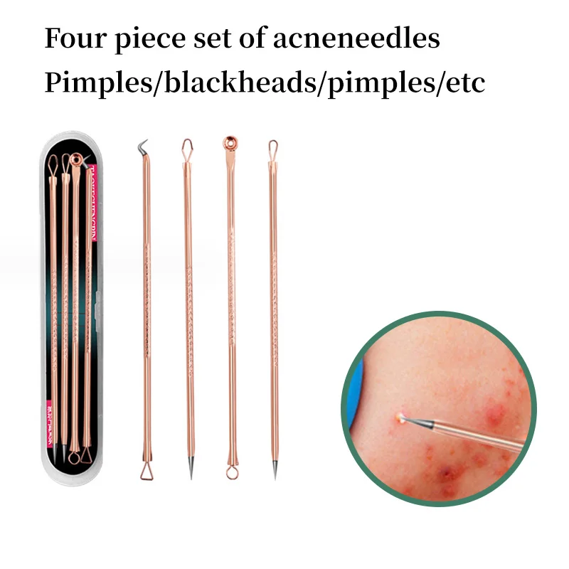 Rose Gold Acne Needles 4-Piece Set Of Non-Sensory Acne Breakout Extremely Fine Ultra-Pointed Needle Squeeze Acne Special Tools