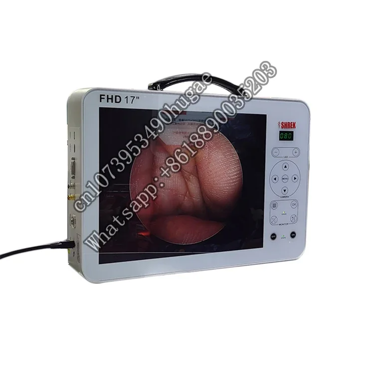 medical full hd laparoscopic system portable unit equipment with 17 inch