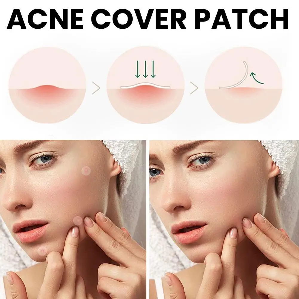 360Pcs Acne Pimple Patch Sticker Waterproof Acne Treatment Pimple Remover Tool Blemish Spot Facial Mask SkinCare Hidden Pimple