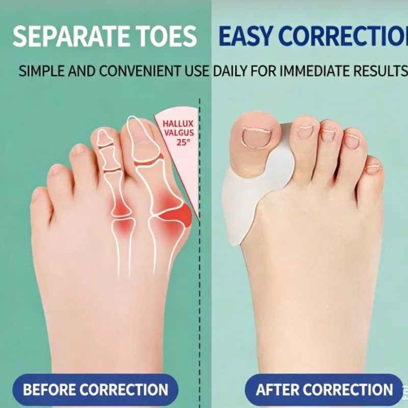 Comfort Silicone Big Toe Protector Covers 1 Pair Unisex Separator for Bunion Relief Foot Pain Care