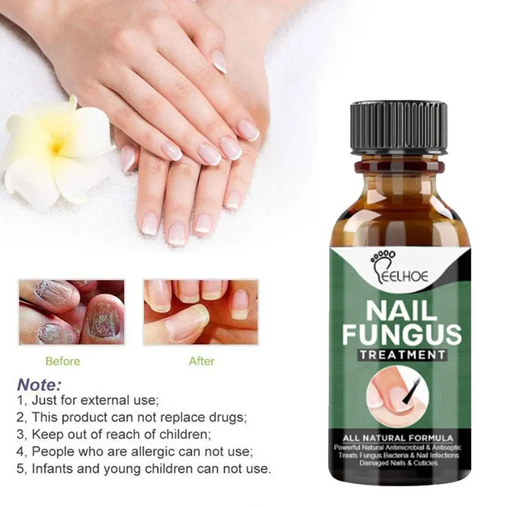 Nail Fungal Treatment Feet Care Essence Nails Foot Fungus Toe Removal Paronychia Anti Infection Repair Onychomycosis Nail O B7M8