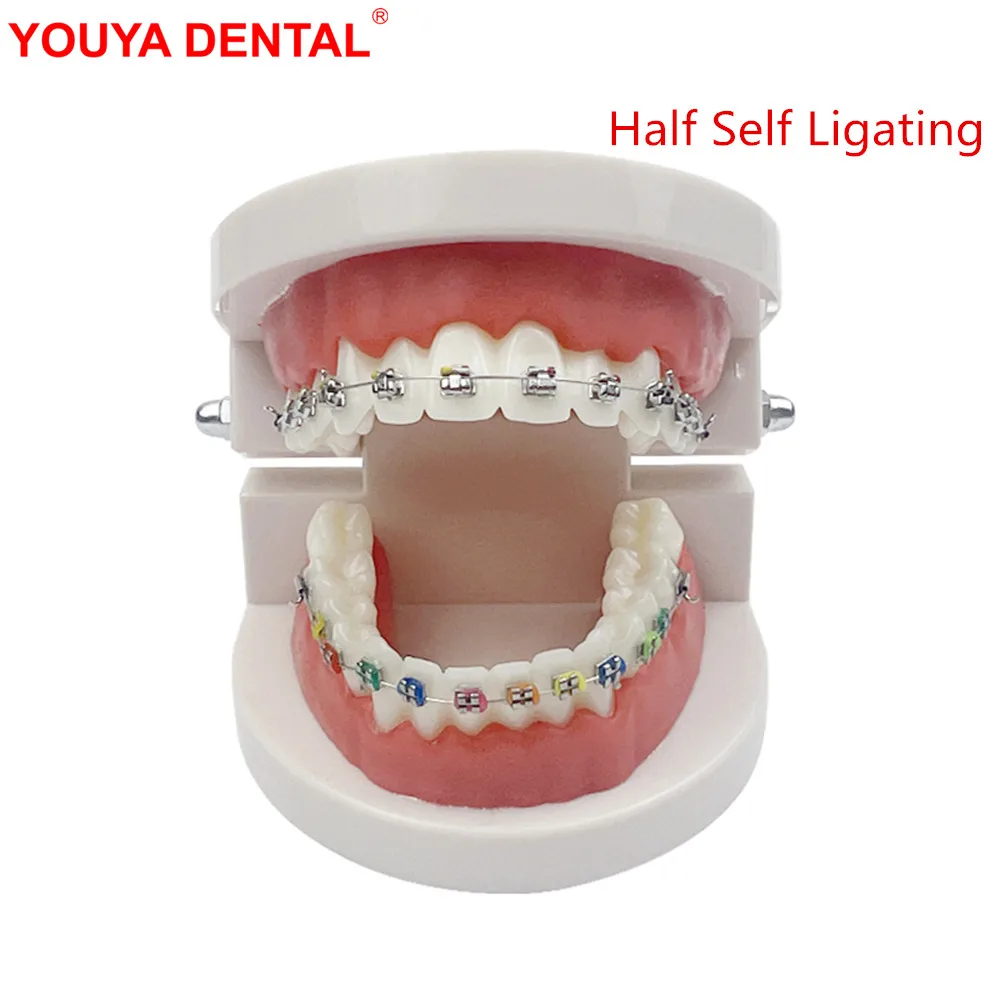 Dental Typodont Orthodontic Model Half Self Ligating Normal Metal Bracket Comparison Ortho Teeth Model With Braces For Teaching