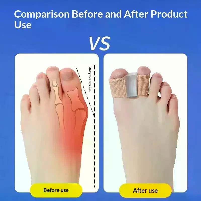 1/2PCS Silicone Toe Spreader Finger Separator Valgus Corrector Thumb Correction Straightener Foot Care Orthopedic