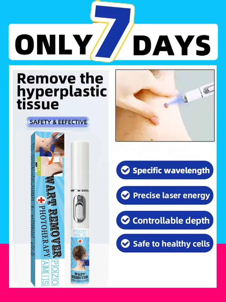 جذر إصلاح الثآليل الجيل السادس عشر المحسن بسرعة واحدة #4