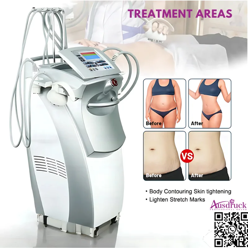 เครื่องเสริมความงามกระชับสัดส่วนระดับมืออาชีพสำหรับการกระชับผิว การกระชับและปรับรูปทรงใช้ในร้านเสริมสวย