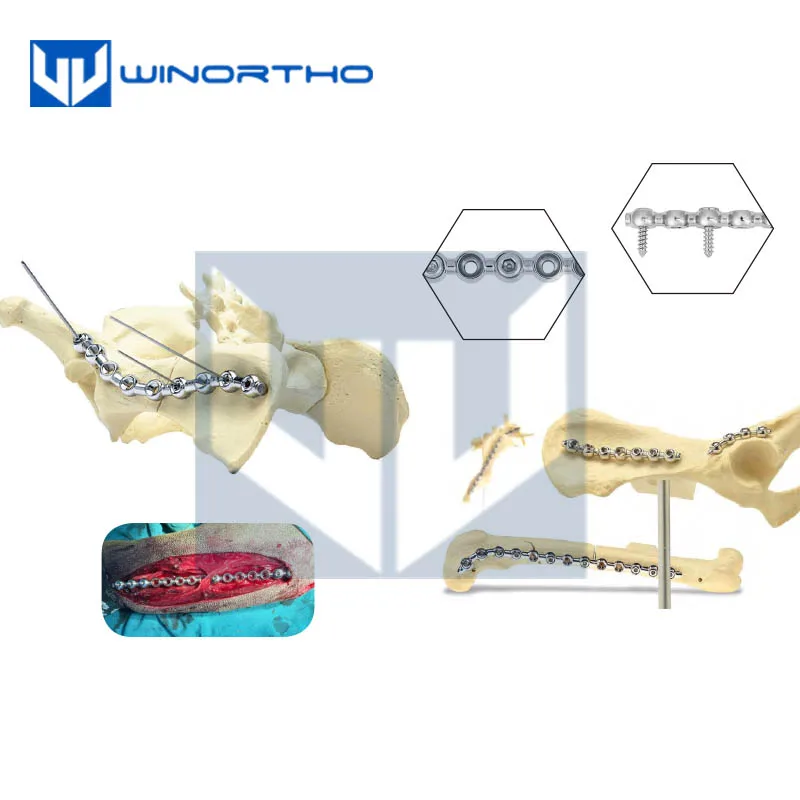 SOP PEARL locking bone plate ALPS veterinary orthopedic instruments  TPLO pet animal surgical  winortho kyon cortex screws