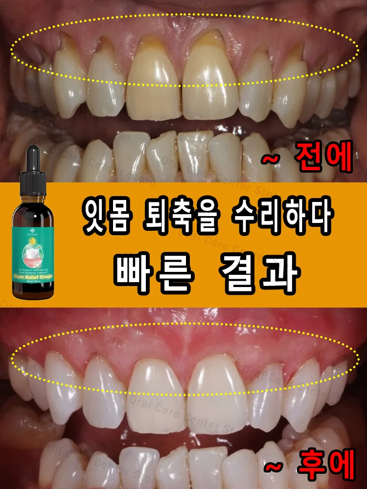 Save gums