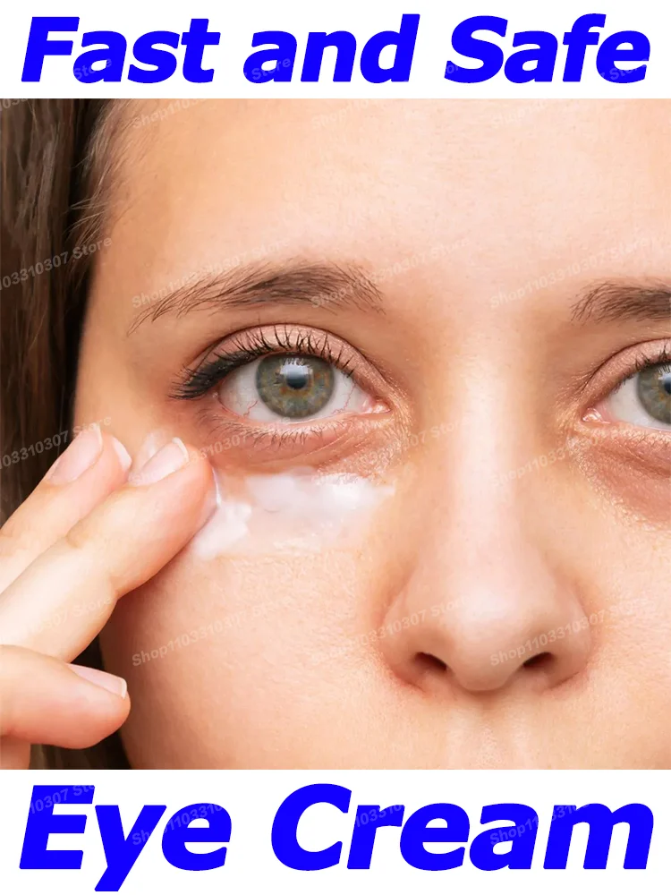 Eye Cream Bags Removal Dark Circles Puffiness Away Work Under Eyes