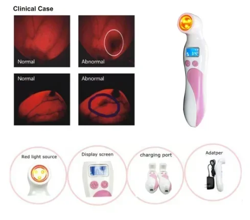 

Home Rehabilitation Physiotherapy Self-Check Device Detecting Mammography Equipment Breast Cancer Test