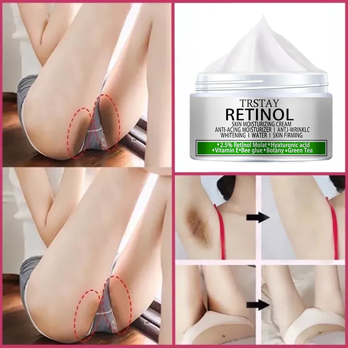 Whitening Cream Private Parts Whitening Bleaching Face Body Lightening Cream Underarm Armpit Whitening Cream Legs Knees