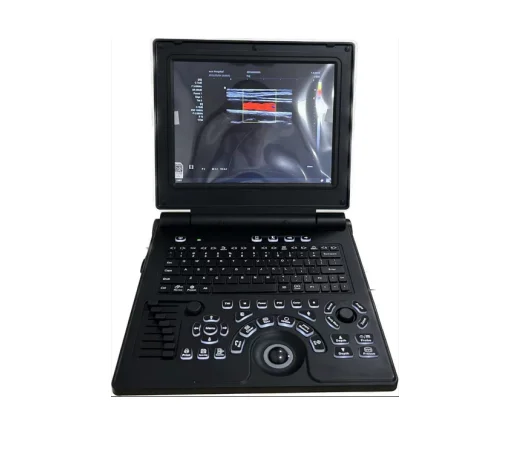 Price Offer Portable Notebook Color Doppler 12-inch high definition display Color Doppler Ultrasound Diagnostic Instrument