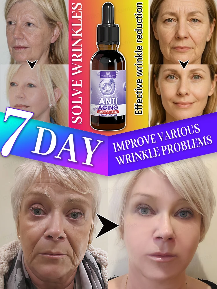 Znikają zmarszczki, pierwszy wybór dla miłośników urody