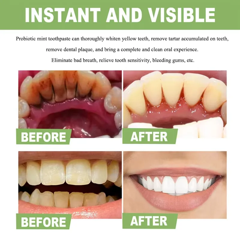 Pasta de dientes en polvo para blanquear los dientes, elimina las manchas de placa, limpieza, higiene bucal, mal aliento fresco, herramientas de blanqueamiento Dental, cuidado