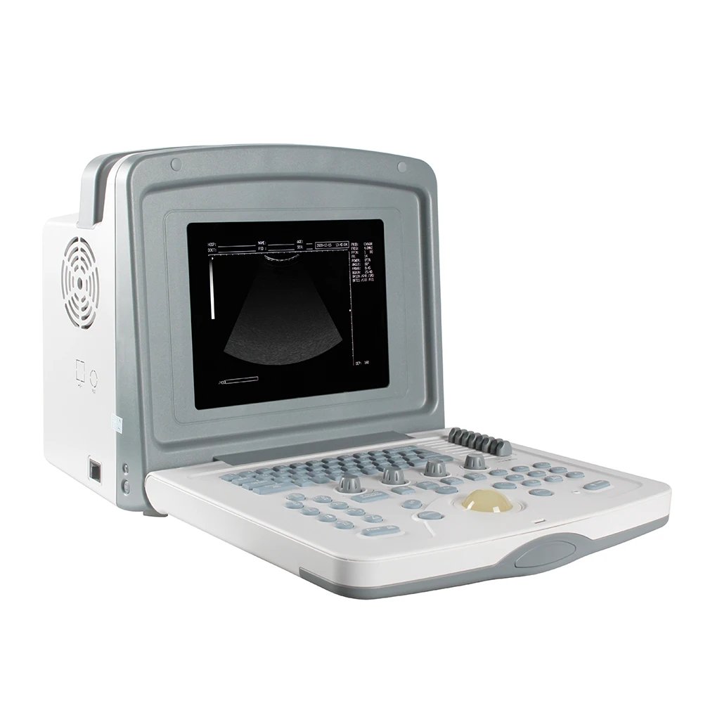 

Professional Full Digital Color Doppler Ultrasonic Diagnostic System Medical Ultrasound Instrument Scanner Price