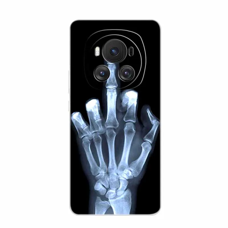 For Honor Magic6 Pro Case Fashion Cool Animal Clear Silicone Soft TPU Phone Case For Honor Magic 6 Pro Back Cover Case 6Pro 6.8\