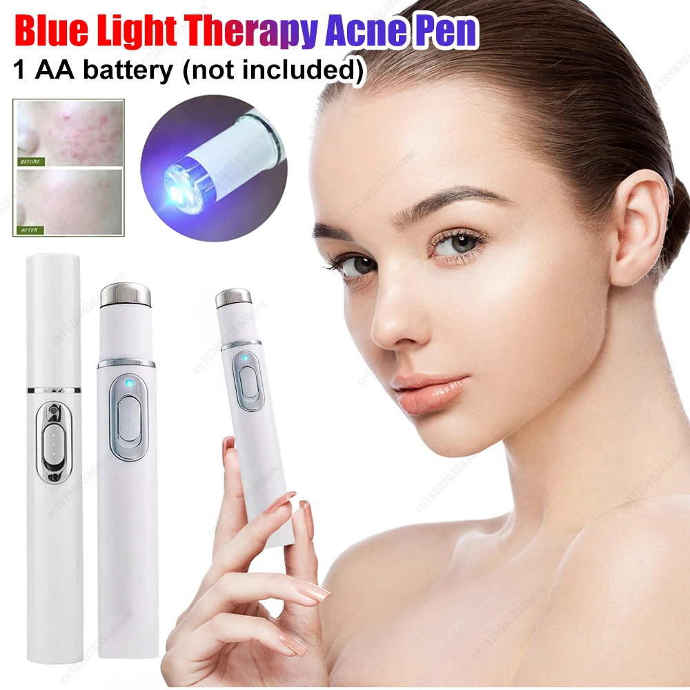 1PCS Blauw Licht Therapie Acne Pen Verwarmde Oog Schoonheid Apparaat Oogmassage Instrument voor Donkere Kringen Oogzakken Wallen onder de ogen