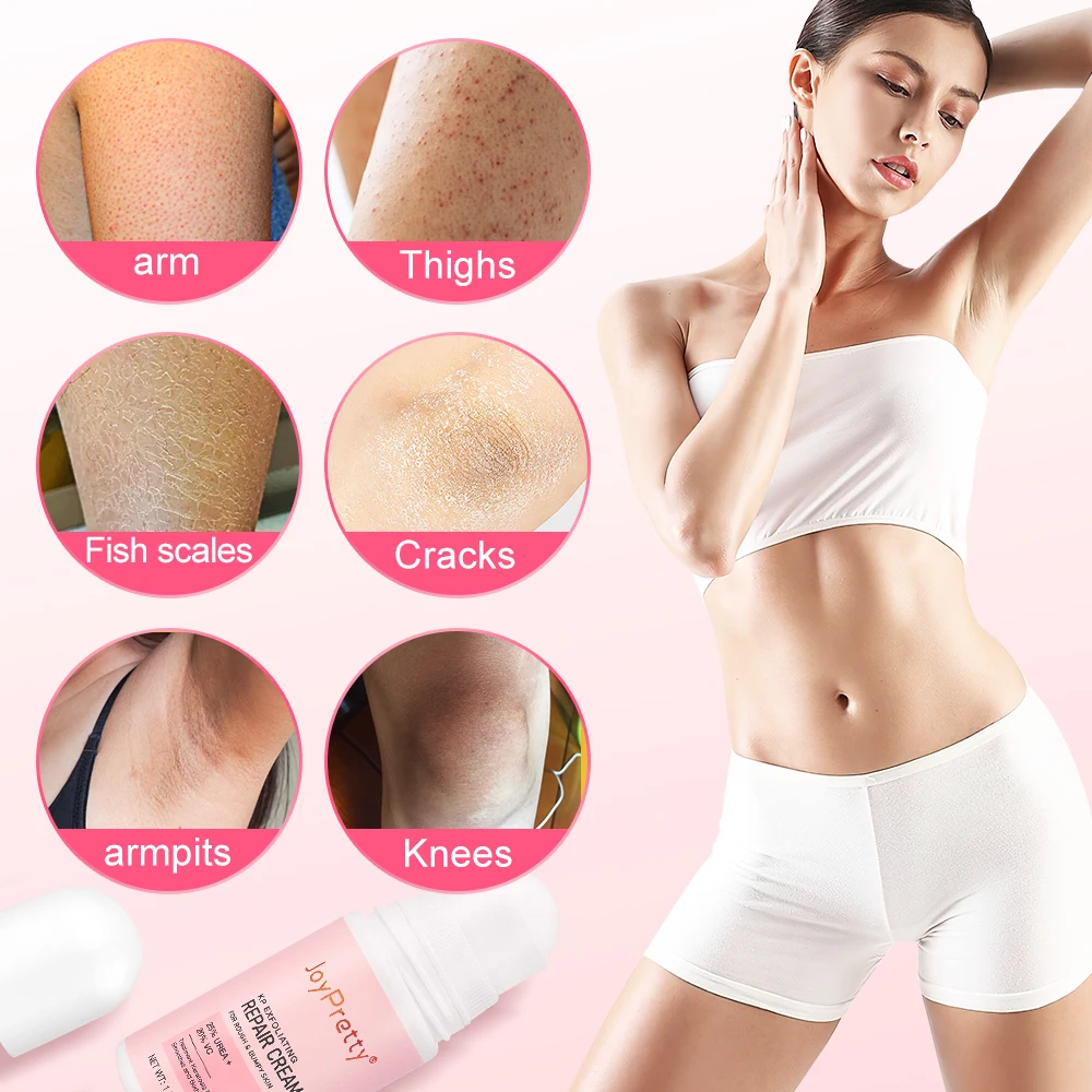 Vitamin C Body Cream Skin Keratosis Pilaris Lotion Rough Bumpy Pore Moisturizing Underarm Brightening Body Creams