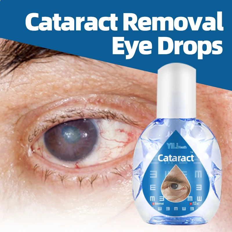 

Cataract Removal Eye Drops Improve Macular Degeneration Blurred Vision Eye Discomfort Glaucoma Presbyopia Treatment Eyes Drop