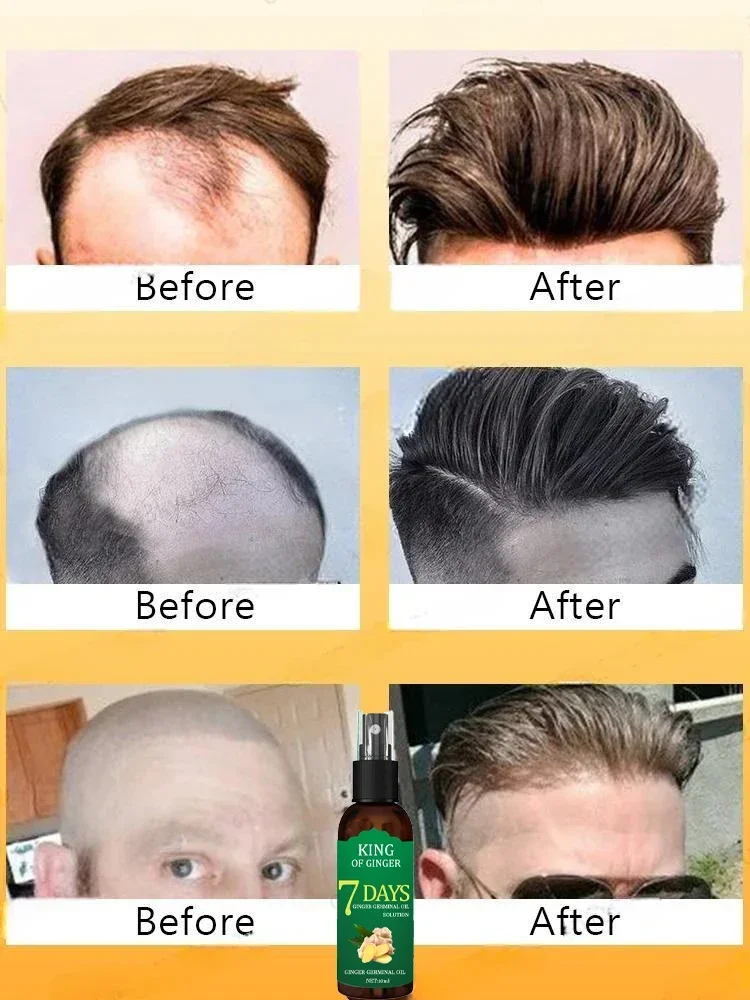 98% of customers repurchase, have more and more hair, say goodbye to baldness