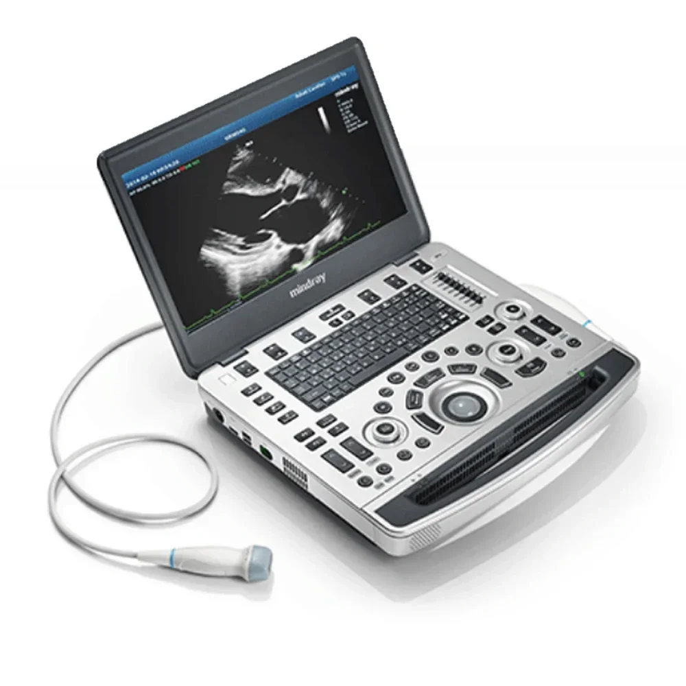 

Mindray M9 Ce Iso Approved High Capacity Replay 12'' Color Led Screen Portable Ultrasound Scanner Machine