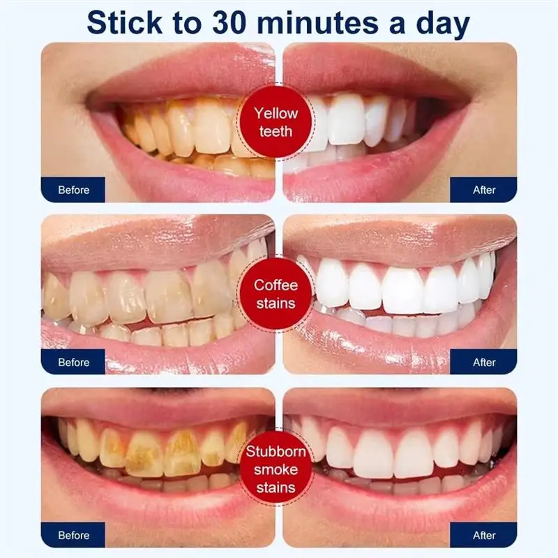 Purple Whitening Teeth Stickers 14 Pairs Gel Whitening Strips Stain Removal Oral Hygiene Care Strip Dental Bleaching Tools Teeth