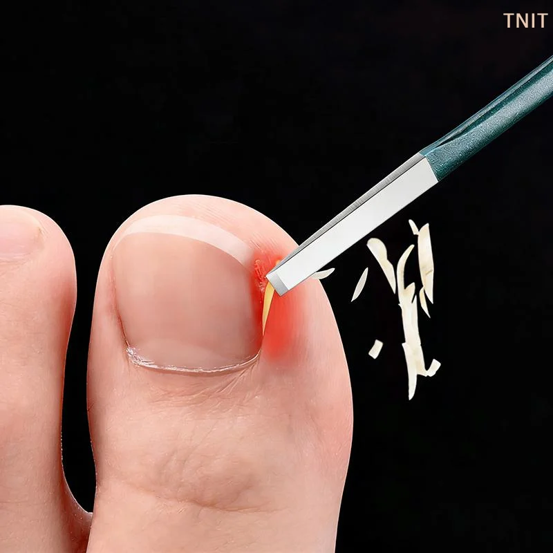 

[J] 2pcs/box Foot Repair Tool, Nail Groove Special, Long Flesh Nail Embedding Tool, Foot Massage Shop, Dead Skin