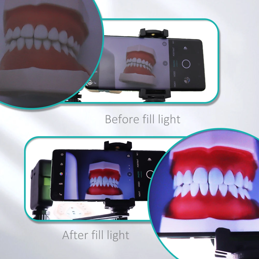 Fotografia móvel dental led luz bluetooth intraoral foto vídeo lanterna iluminação para dentista tratamento lâmpada equipamentos