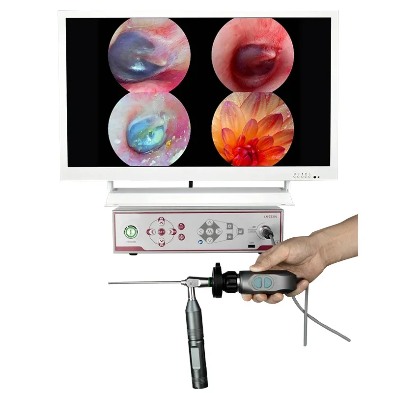 The 1080P uses an ear-specific endoscope ca-me-ra a 21.5-inch pet FHDmedical ca-me-ra and a portable cold lightsourcecombination