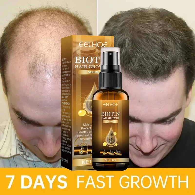 

Biotin Fast Hair Growth Products Anti Hair Loss Serum Spray Prevent Baldness Treatment Scalp Beard Beauty Hair Care Men Women