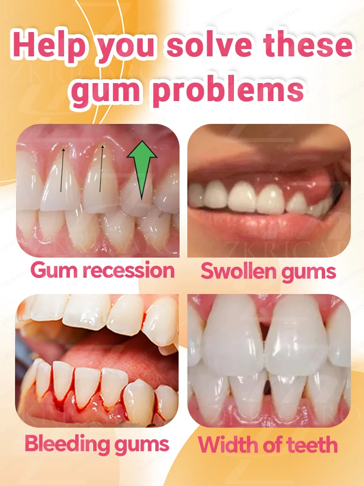 Repair damaged gums, relieve gum pain, strengthen gums, restore healthy gums! ! ! !